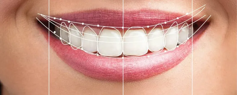 Detalle de sonrisa natural — resultado del diseño digital de sonrisa CAD/CAM en Logroño, La Rioja